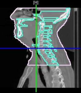 Exporting Contours to DICOM-RT Structure Set