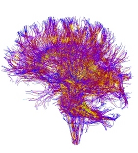 Simultaneous Manifold Learning and Clustering: Grouping White Matter Fiber Tracts Using a Volumetric White Matter Atlas