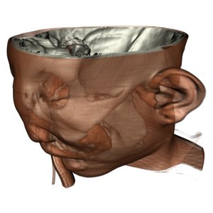 Uniform B-Splines for the VTK Imaging Pipeline