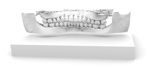 A Spline-Driven Image Slicer