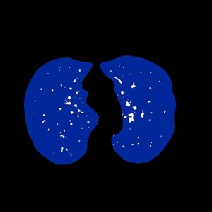 Fuzzy Clustering Algorithms for Image Segmentation
