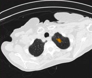 Fostering Open Science in Lung Cancer Lesion Sizing with ITK module LSTK