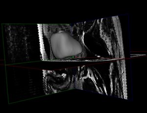 Importing Contours from DICOM-RT Structure Sets with ITK4