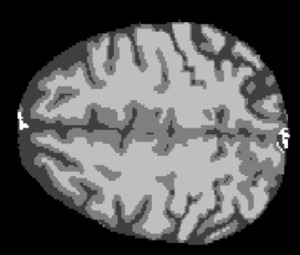 A generic interpolator for multi-label images