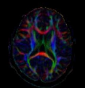 A new implementation of itk::ImageToImageFilter for efficient parallelization of image processing algorithms using Intel Threading Building Blocks