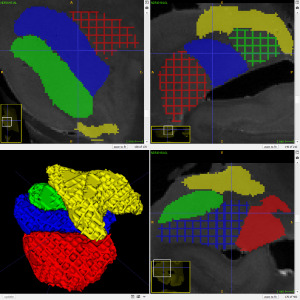 ND morphological contour interpolation