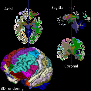 RLEImage: run-length encoded memory compression scheme for an itk::Image
