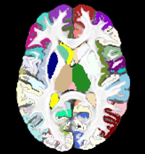 A patch-based framework for new ITK functionality: Joint fusion, denoising, and non-local super-resolution