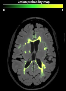 An Empirical Optimization to Logistic Classification Model